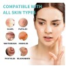 Lusabe Parches Para Acn Invisibles 36pzs Pimple Patch