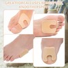 QIYUDA 24 Pieces Callus Pads for Bottom of Foot, Adhesive