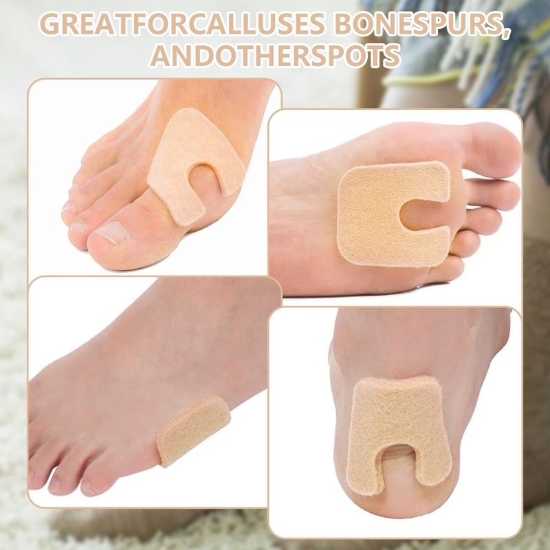 QIYUDA 24 Pieces Callus Pads for Bottom of Foot, Adhesive