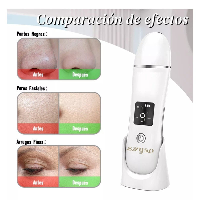 Ezzyso Limpiador Ultrasónico Scrubber Facial Skin Peeling Portatil