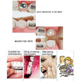 Angzhili 10 Pack Dental Orthodontics Oral Care Wax for Braces,Fruit Smell Brace Wearers Flavored Gum Protection for Relieve Oral Pain (Multi-Color)