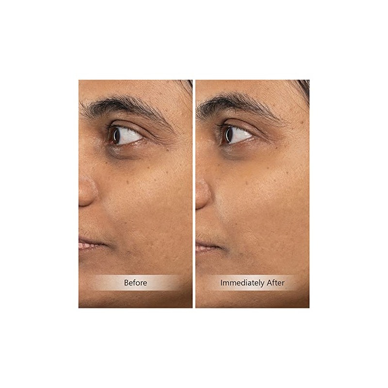Relleno instantáneo activador juvenil