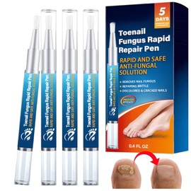 Nail Building Serum – 4-Piece Nail Repair & Care Pen Set for Damaged, Broken & Discoloured Nails – Nourishing Nail Treatment for Fingernails & Toenails – Strengthens, Restores & Promotes Healthy Nail Growth