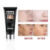 Perfection Eye Tightener, Instant Face Lift Cream, Eye Cream for