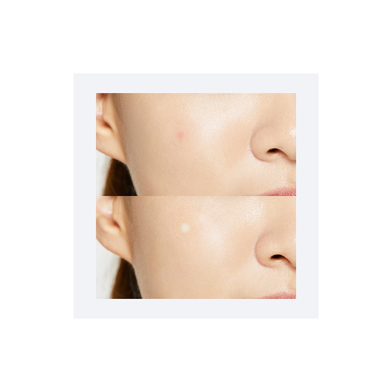 COSRX [COSRX]Acne Pimple Master Patch (3ea X 24 patches)