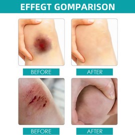 10ml Liquid Bandage,Skin Glue for Wounds Human,Breathable Healing Gel,Waterproof Plasters for Wounds,Liquid Skin Bandage,Waterproof Wound Care for Cuts & Scrapes,Breathable & Invisible,Promote Healing