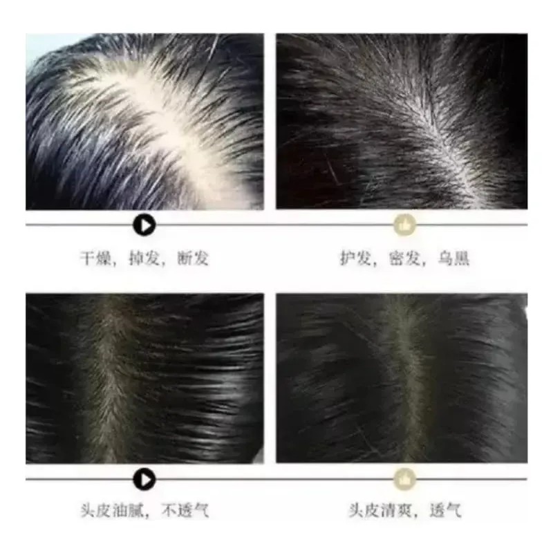 3 Shampoo Reparador Raíz Jengibre Anticaída Crecimiento