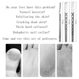 3PCS Stainless Steel Ingrown Toenail Pedicure Knife Set, Professional Pedicure Tool Peeling Knife for Nail Corn Callus(with Whetstone)