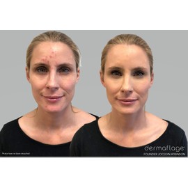 Waterproof Concealer Cream, Full Coverage Waterproof Makeup, Color Match Promise by Dermaflage, 6g/.2oz