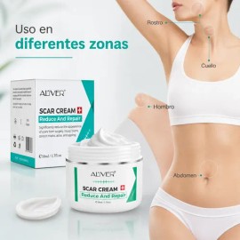 Crema Para Cicatrices Estrías Marcas Visibles Cuidado Piel