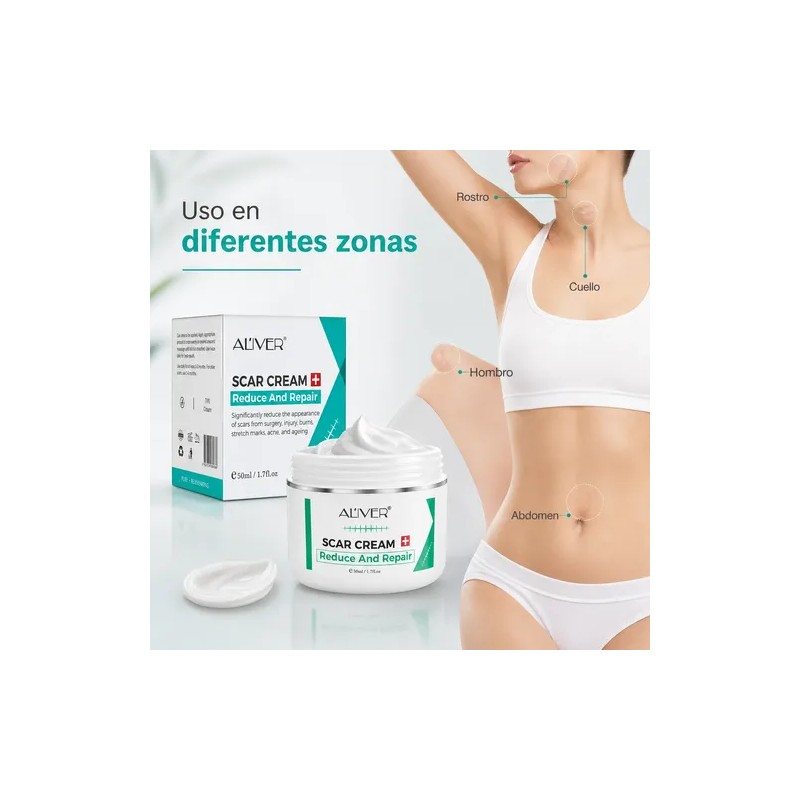 Crema Para Cicatrices Estrías Marcas Visibles Cuidado Piel