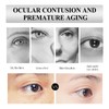 Peptide Eye Serum with Massage Roller – Under Eye Cream