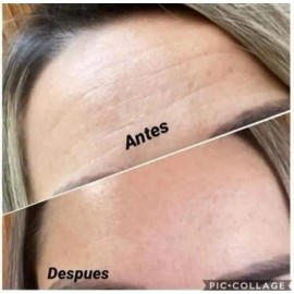 Crema Con Colágeno  Ácido Hialurónico Shelo Nabel, Arrugas                                                                                            
