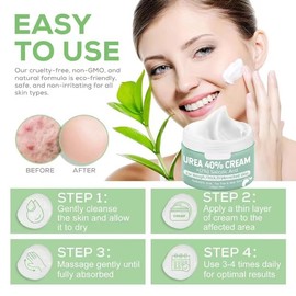 Urea Cream 40 Percent for Feet - Urea Foot Cream - Callus and Dead Skin Remover, Deeply Moisturize, Repair Dry, Cracked, Rough Skin of Heel, Elbow and Knee 150g