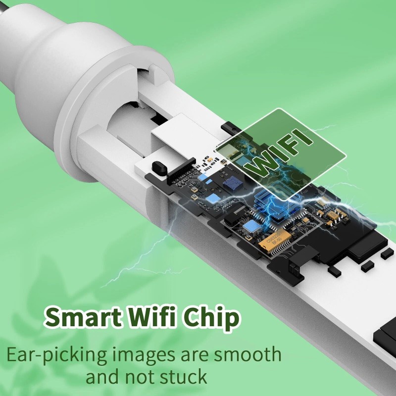 Ear Wax Removal Kit: 1920P HD Camera & 8-Pc Ear