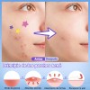 560pzs Mascarillas Estrella Acne