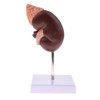 Kidney Model Anatomy Normal Human Anatomical Teaching Doctors Office Educational