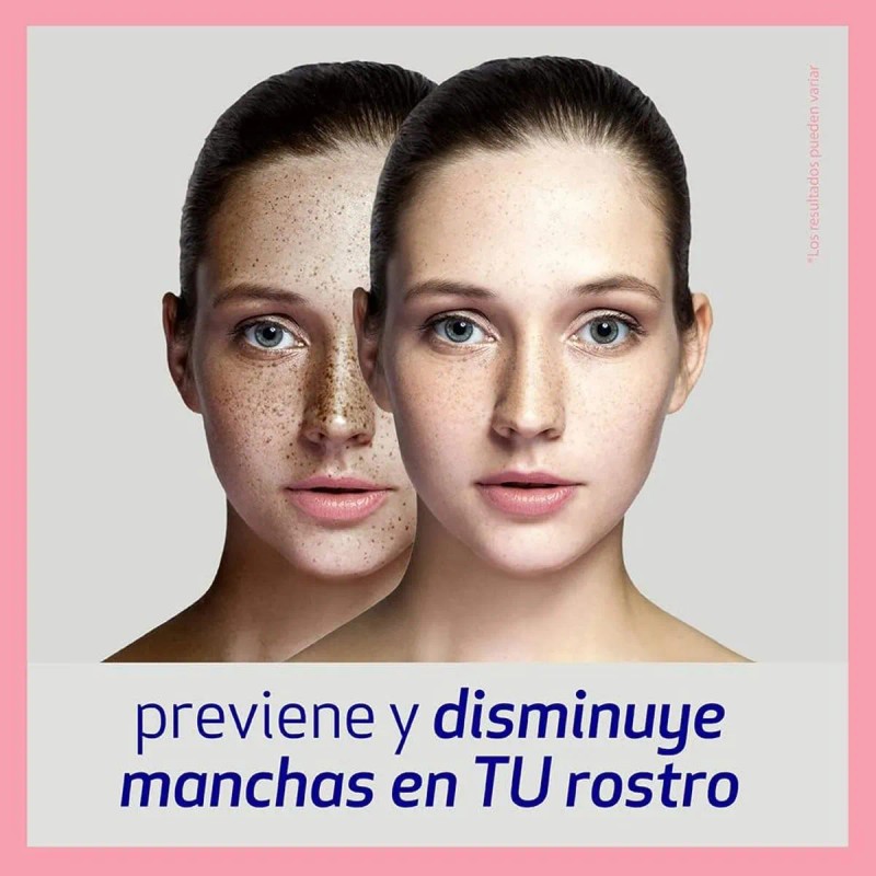 Crema Aclaradora Rostro Manchas 50g Joseph Tipo Piel Todo