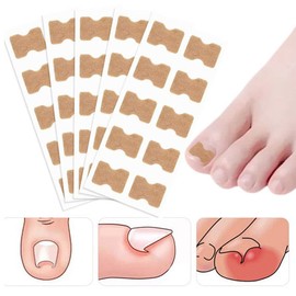50 Pcs Glue Free Toenail Toe Ingrown Nail Correction Patch Nail Sticker Foot Care, Nail Correction Stickers for Men Women