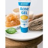 Grahams Natural Acne Gel 30g