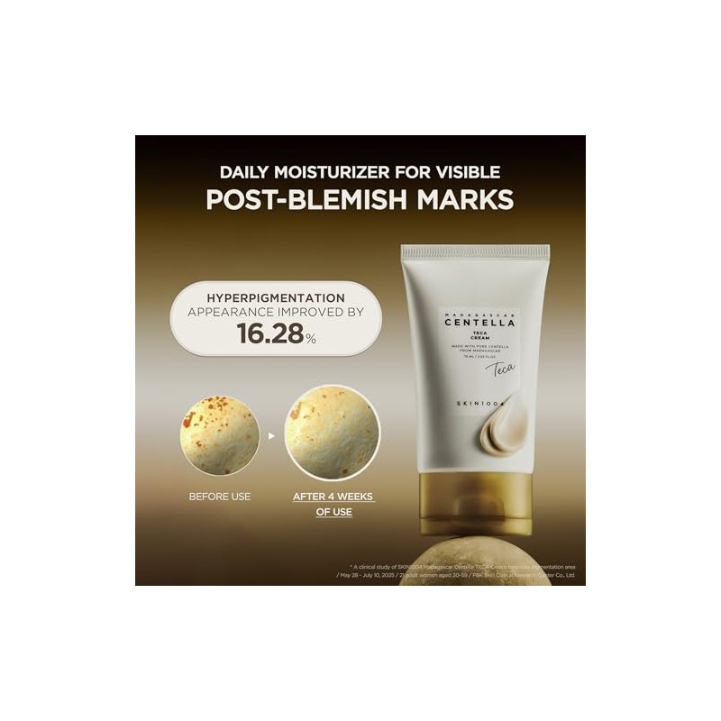 SKIN1004 Madagascar Centella TECA Cream, Korean Centella Face Moisturizer for