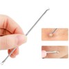 KAV Comedone Extractor Kit 5-Piece Blackhead Remover Tool Set with