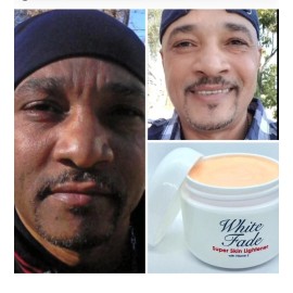 Crema aclaradora White Fade Super Skin, Para Piel Triguena O Morena 2 Oz.