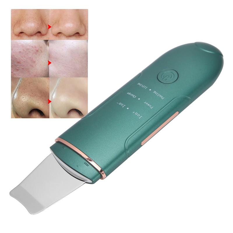 EMS Ultrasonic Skin Scrubber Blackhead Pimple Removal Lifting Ion Pore
