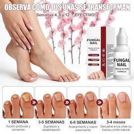 2PCS Tratamiento De Uñas, Cuidado De Uñas, Suero Para El Crecimiento De Uñas, Tratamiento para Uñas Descoloridas y Gruesas | Cuidado Intensivo para Uñ