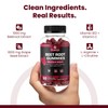 VITAMIZED Beet Root Gummies - Super Nitric Oxide Beets Supplement