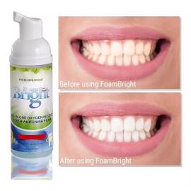 Foam Bright Limpiador De Espuma De Retención Y Blanqueamiento De Dientes