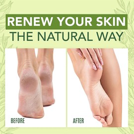 Hydrating and Anti-Cracking Fußcreme, Fusscreme Sehr Trockene Füsse Fußpflege, Feuchtigkeit Hornhautentferner Creme, Anti-Riss Fußcreme, für Rissige Fersen und Trockene Haut, shentiru