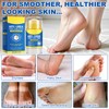 WHLH & WELL-BEING Urea Foot Care Stick & Cream -