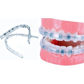 Comfort Cover for Braces, Lip Protector Mouth Guard Lip Cushion Teeth Shield Bumper for Brackets, Aligner, Dental Wax Alternative, Hard and Rigid Clip