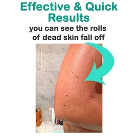 Elbahya Spa Premium - Guante exfoliante exfoliante facial y corporal, elimina puntos negros, elimina la piel muerta, reduce la queratosis pilaris, puntos negros, golpes, para ducha, spa, masaje celulitis y exfoliantes corporales