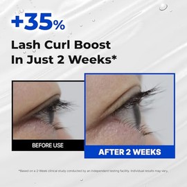 EPAIS Essential Eyelash Growth Serum, Jumbo Size 15ml/0.5fl.oz - Safe & Gentle Lashes Care, Nutrient Formula for Longer, Fuller, Thicker in 2 Weeks, P