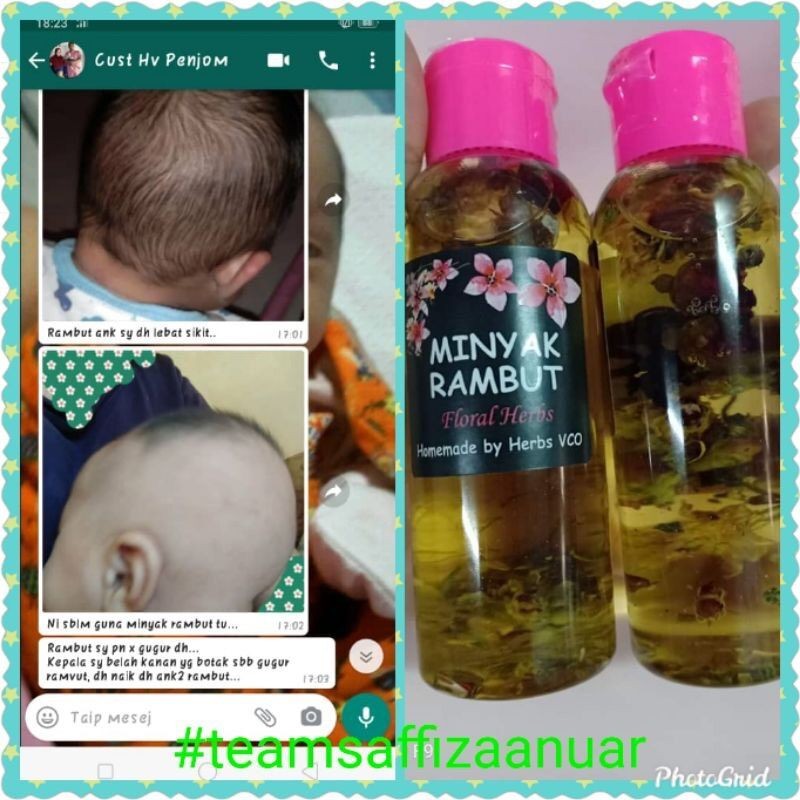 vco 🔥BEST SELLING🔥🎁+ MINYAK RAMBUT FLORAL HERBS [TANPA BAHAN KIMIA]