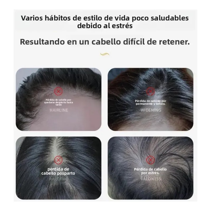 Adult Anti-hair Loss Serum | Nourish Y Brilla | Careful
