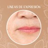 Crema Despigmentante Para Manchas, Melasma, Acné Y Paño