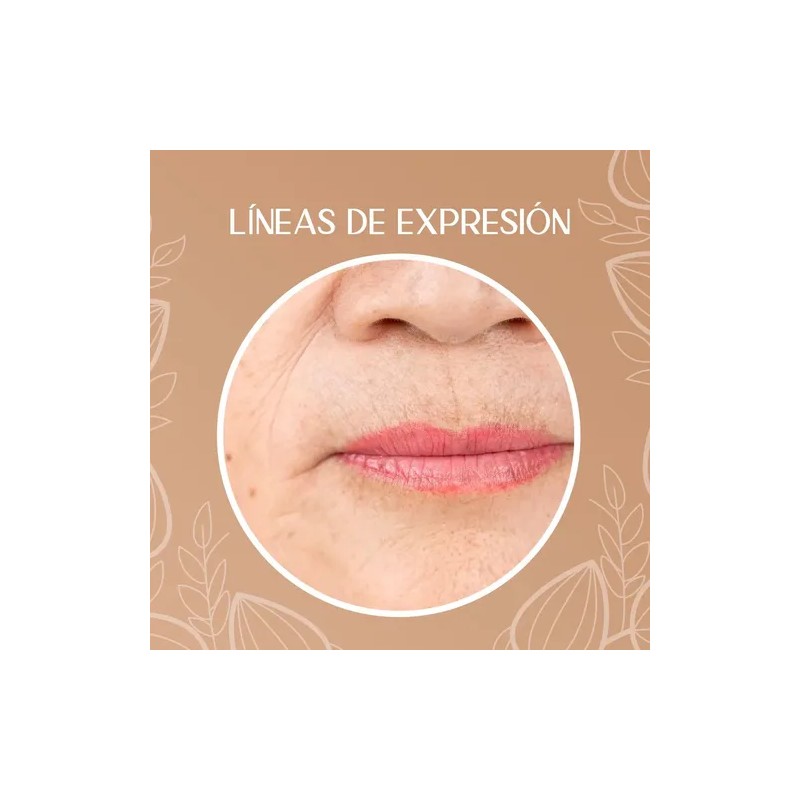 Crema Despigmentante Para Manchas, Melasma, Acné Y Paño
