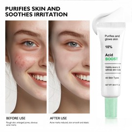 10% Azlaic Acid Booster Cream Gel,Azlaic Acid Cream for Face,A/zlaic A/cid Cr/eam 10%,A-zlaic Ac-id Gel,Acne Treatment Cr-eam,Acne Cre-am,Skin Tightening Crea-m for Fa-ce,Azlai-c Aci-d Serum