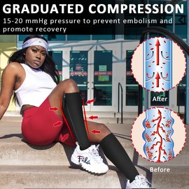 Ailaka Medical Compression Socks with Zipper, Knee High 15-20 mmHg Compression Socks for Women Men, Open Toe Support Socks for Varicose Veins, Edema, Recovery, Pregnant, Nurse