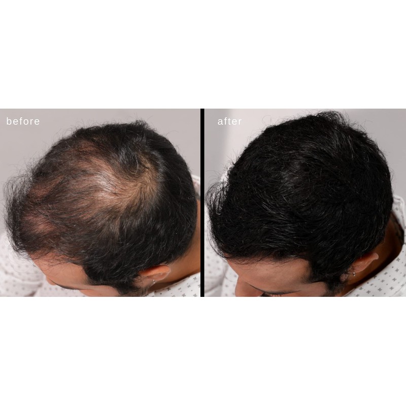 LUXE Hair Thickening Fibers - CONFIDENCE IN A JAR –