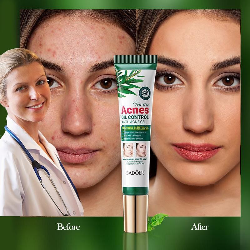 SDAOER TEA TREE ACNESOIL CONTROL ANTI-ACNE GEL 20g - Specification: