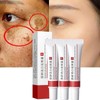 Crema para Manchas Oscuras en La Cara, Cremas para Quitar