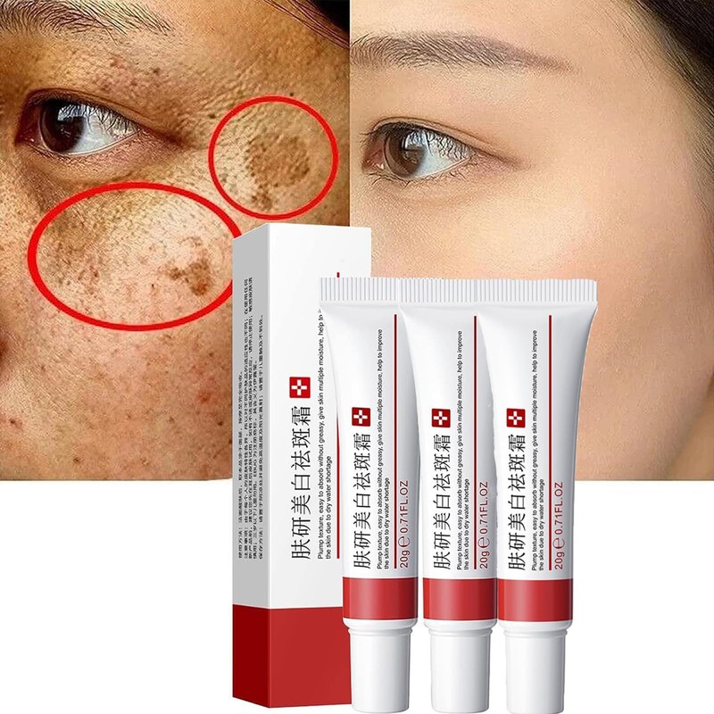 Crema para Manchas Oscuras en La Cara, Cremas para Quitar