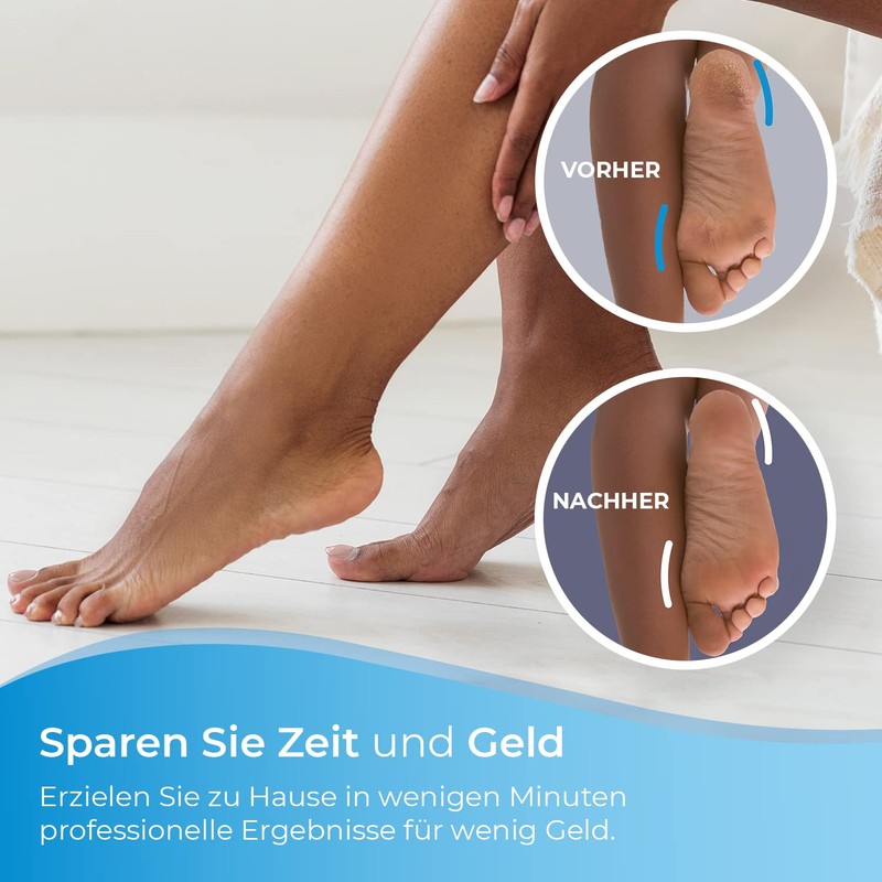 My Rollers™ Mineral Ersatzrollen (grau) für Emjoi Micro Pedi im