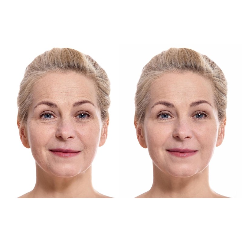 Vitality Precision Skin Micro Exfoliation Scrub / 바이탈리티 프리시전 스킨
