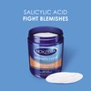 Noxzema Ultimate Clear Face Pads, Salicylic Acid Acne Treatment Clears