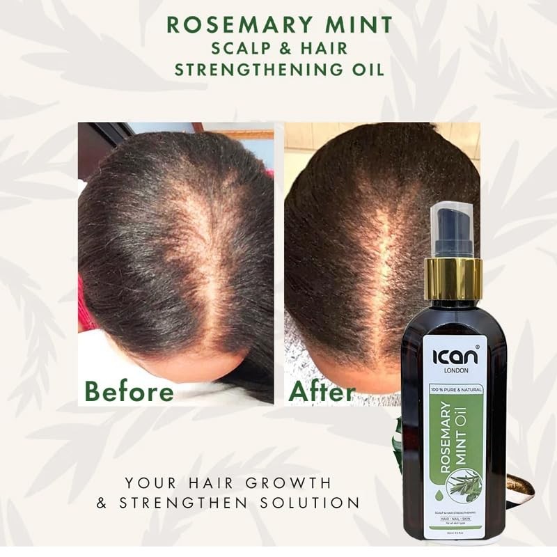 ican London Strengthening & Healthy Hair Growth Rosemary Mint Treatment